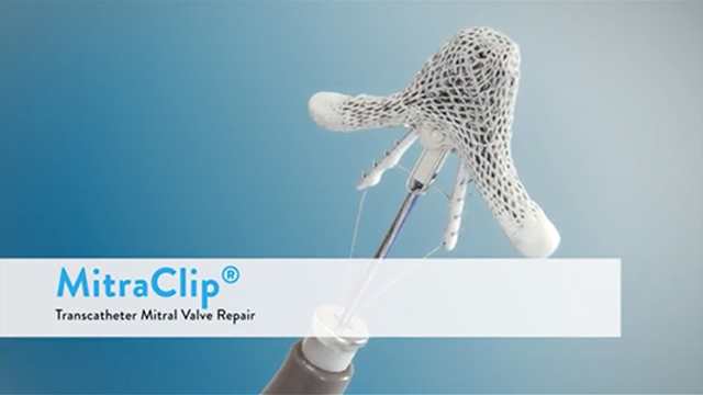 MitraClip procedure